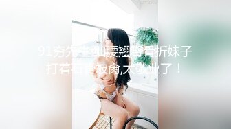 91夯先生 细腰翘臀骨折妹子打着石膏被肏,太敬业了！